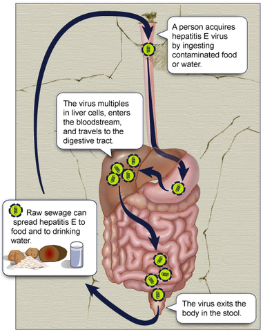 Hepatitis Liver