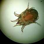 Scabies Under Microscope