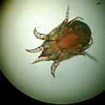 Scabies Under Microscope Scabies Under Microscope